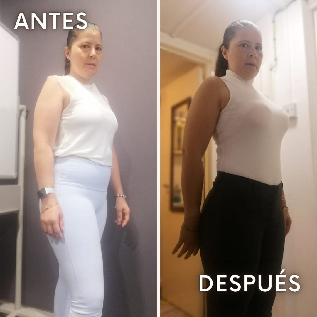 Astrid - antes y después