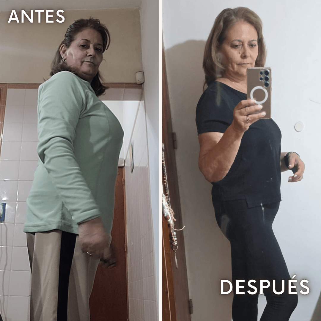 Graciela - antes y después