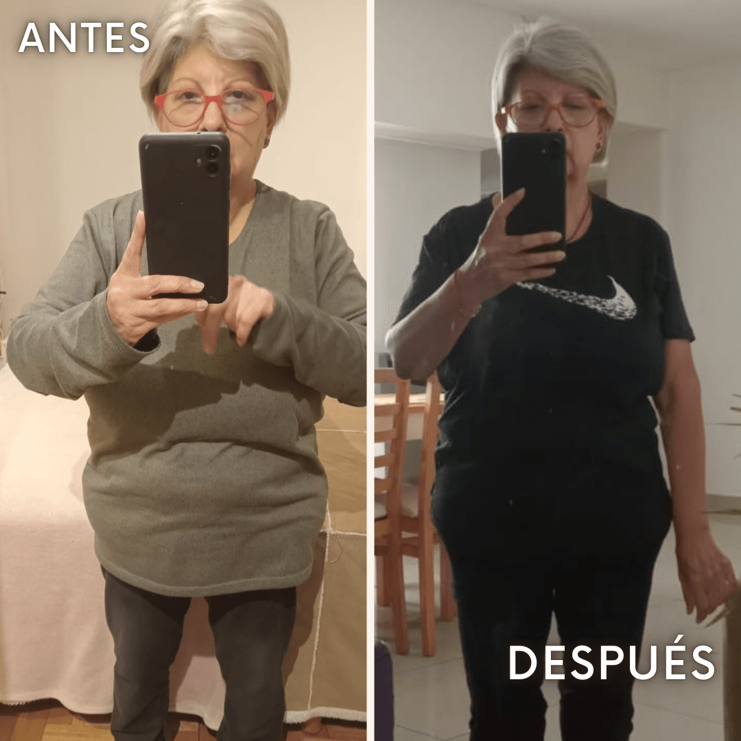 Sil - antes y después
